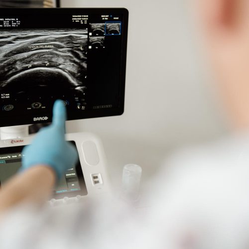 tratamiento ecoguiados 4